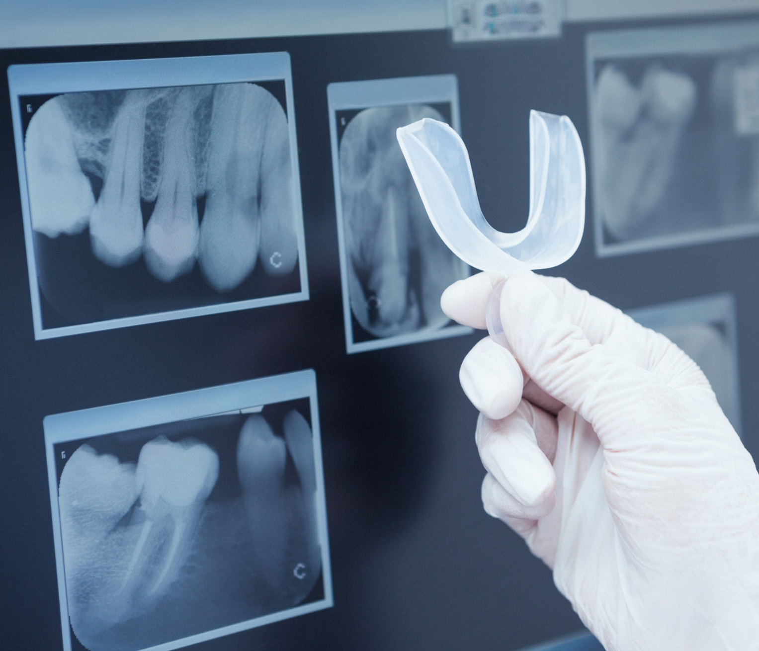 Diagnostyka radiologiczna